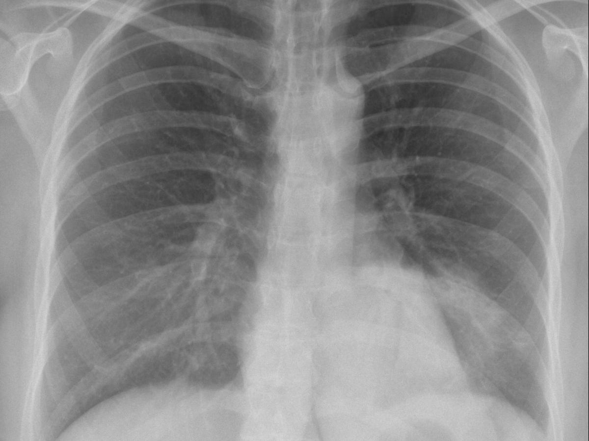 Screw Bali And The Broken Scooter It Rode In&nbsp;On